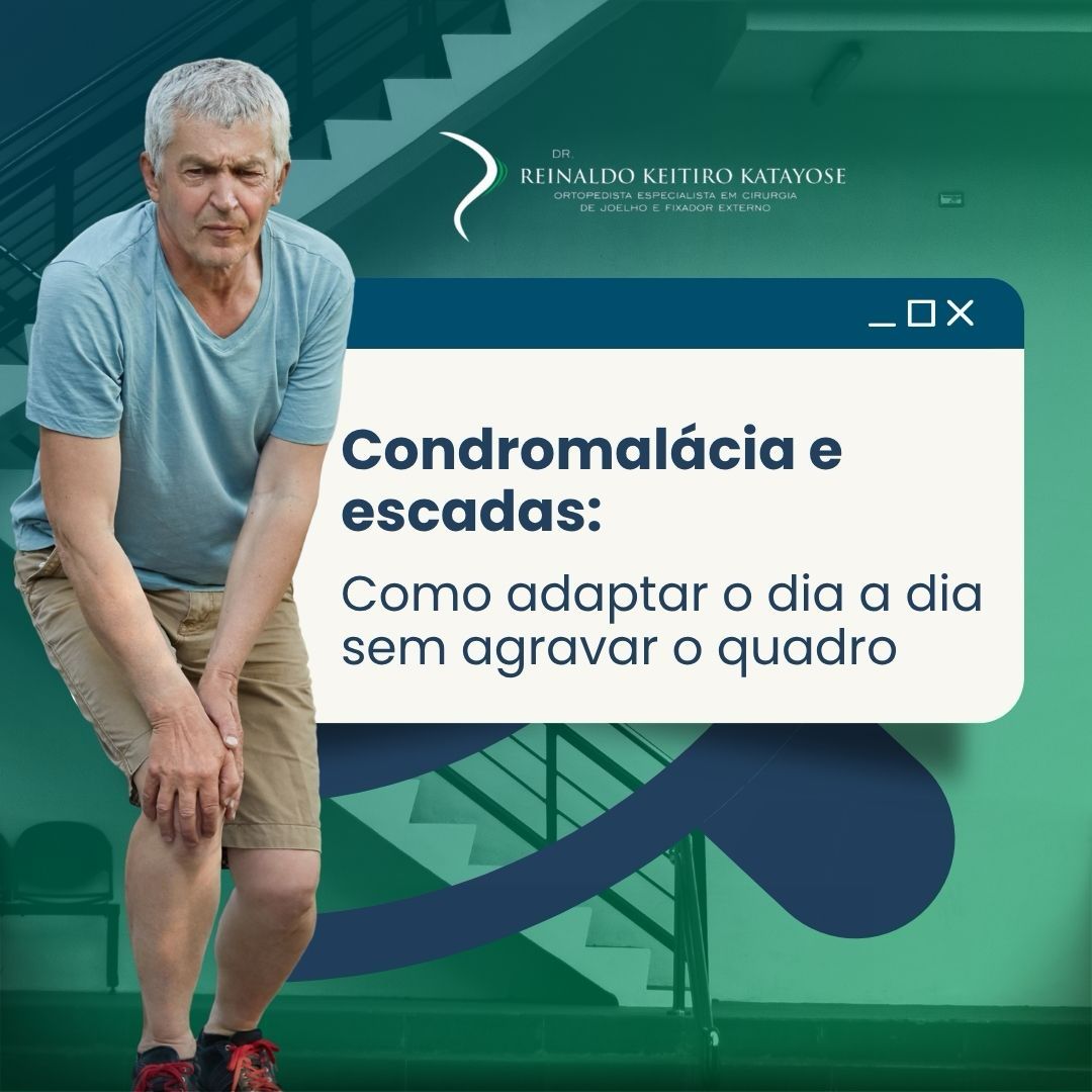 Condromalácia e escadas: como adaptar o dia a dia sem agravar o quadro