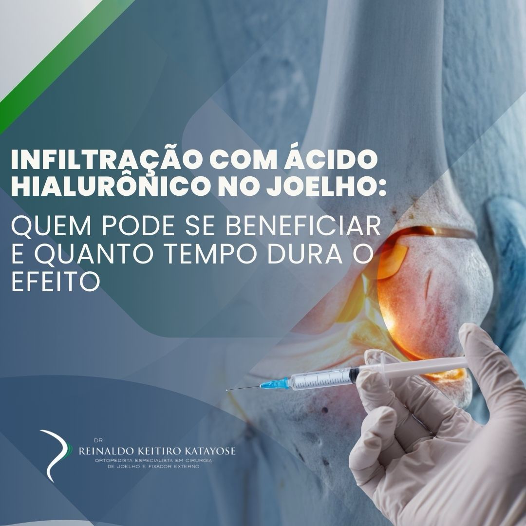 Infiltração com ácido hialurônico no joelho: quem pode se beneficiar e quanto tempo dura o efeito
