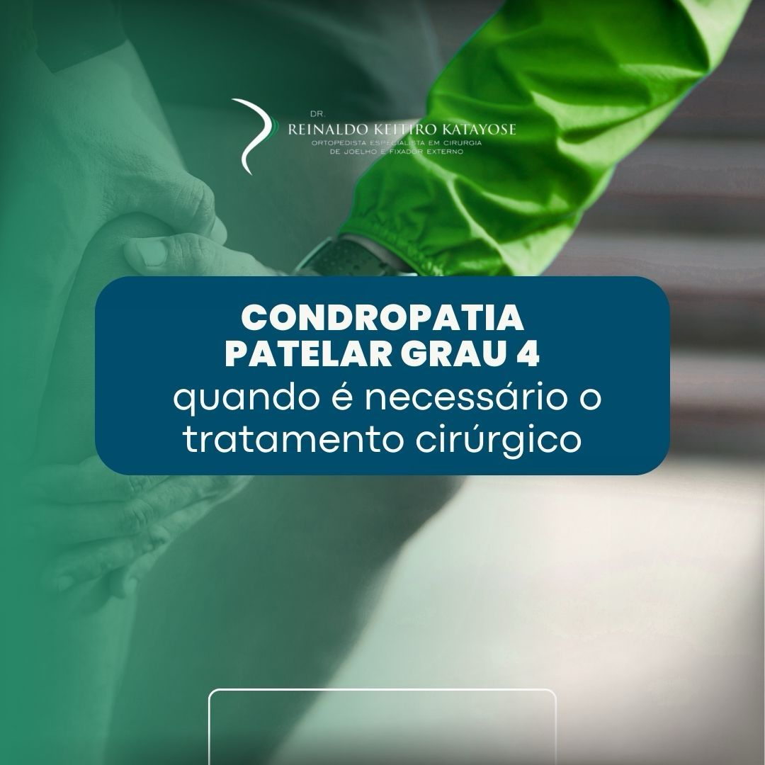 Condropatia patelar grau 4: quando é necessário o tratamento cirúrgico